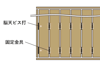 脳天ビス打ち固定